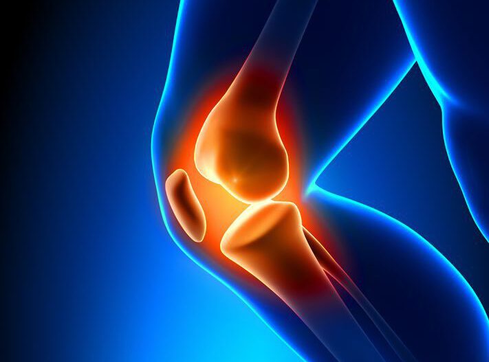 Patienten für Knie-Arthrose Studie gesucht